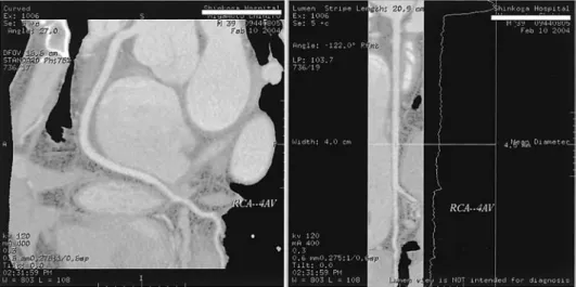 図 3 mul ti pl anerreformati on（MPR）画像（正常右冠動脈）