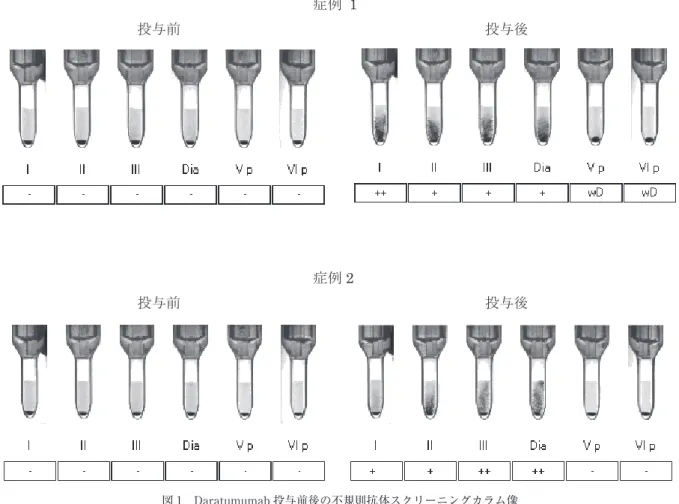 図 1 Daratumumab 投与前後の不規則抗体スクリーニングカラム像 不規則抗体スクリーニングは，全自動輸血検査装置 IH-1000（バイオラッド社）を使用した．I，II，III，Dia は LISS-IAT． Vp，VIp は酵素法（パパイン処理血球）の結果を示す．症例 1 投与後の Vp，VIp の wD は目視でのチェックを必要とする判 定である．  ⑕౛ 2ᢞ୚๓ ᢞ୚ᚋ 現病歴：MM（IgGκ 型）．