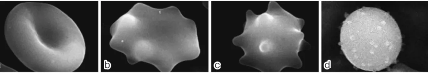 Fig. 3 Morphology of red blood cells Individual cells in (a)‒(d) show the various stages of morphological change that red blood cells undergo during storage, named  discocyte, echinocyte I, echinocyte II and spherocyte, respectively. The morphology score o