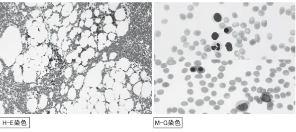 図 1 骨髄穿刺検査