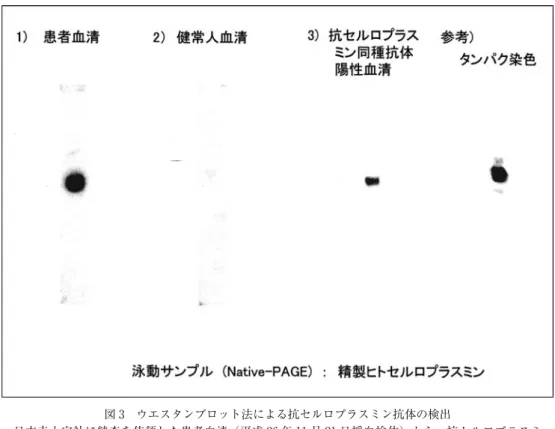 図 3 ウエスタンブロット法による抗セルロプラスミン抗体の検出 日本赤十字社に精査を依頼した患者血清（平成 26 年 11 月 21 日採血検体）から，抗セルロプラスミ ン抗体が検出された． 【ウエスタンブロット検査方法】 8） 精製セルロプラスミンを Native-PAGE や SDS-PAGE など分離後，PVDF 膜に電気的に転写した． BSA などで膜をブロッキング後，希釈した被検血清とインキュベートする．洗浄操作後，結合した抗 体に標識二次抗体を結合させ ECL ウエスタンブロッティング検出システ