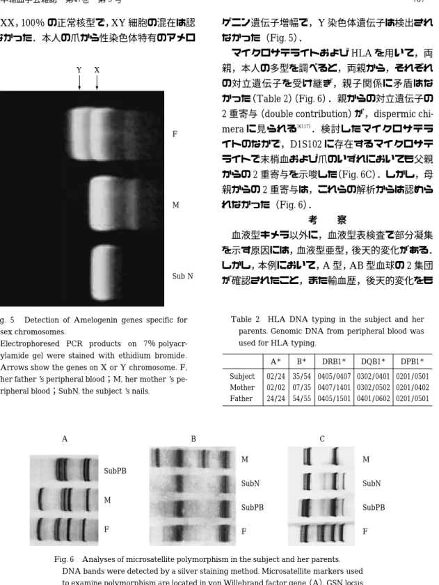 Table  2 HLA  DNA  typing  in  the  subject  and  her  parents. Genomic DNA from peripheral blood was  used for HLA typing
