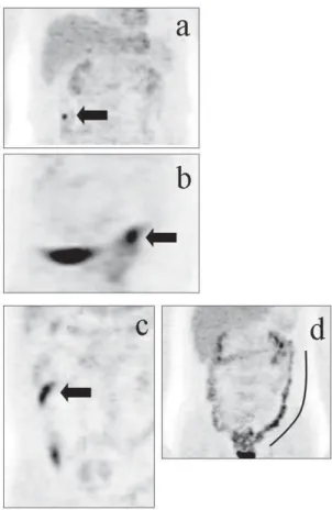 Fig.  4   Representative uptake pattern of FDG in colon/