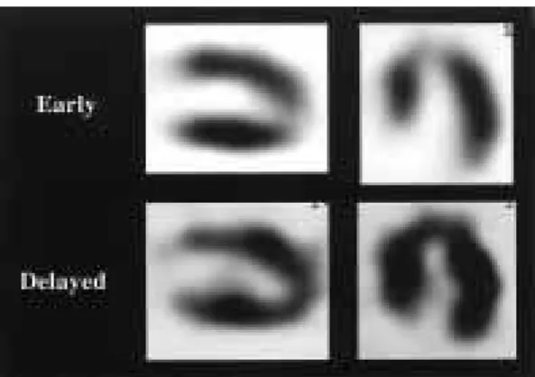 Fig.  2 12 leads-electrocardiography showed normal findings.