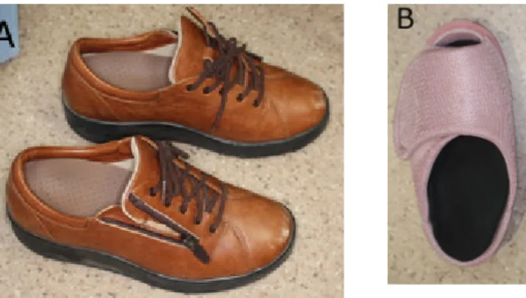 図 4  靴形装具の作成例。(A)室外履き型  (B)室内履き型 