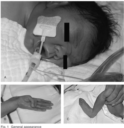 Fig. 1  General appearance A: Senile appearance