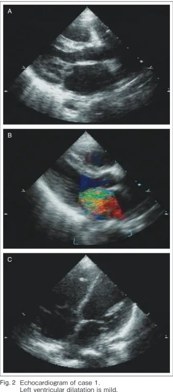 Fig. 2  Echocardiogram of case 1.
