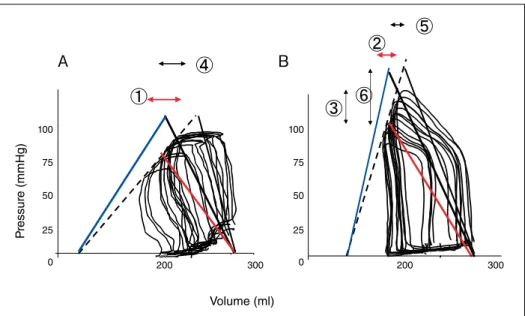 Fig. 4   The prediction of Blood pressure and Cardiac output by PV loopABVolume (ml)2003000 2002550751000255075100 300Pressure (mmHg) 容積関係を理解すると，内情の変化のみならず，負荷 変化に対する心拍出量の変化や血圧の変動，収縮性変 化に対する心拍出量の変化や血圧の変動を予測するこ とができ，きめ細やかな循環管理が可能となる．  さらに本稿では詳細は割愛するが，この心室圧容積