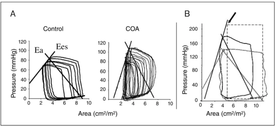 Fig. 5   The differences in ventricular-vascular coupling between post operative CoA and control  subject