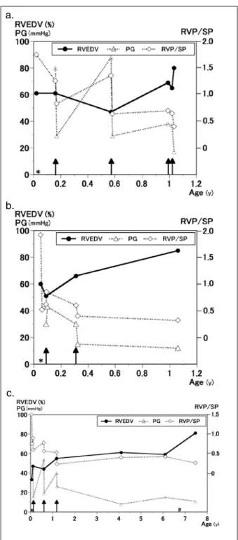 Fig. 2  Changes in RVEDV, PG and RVP/SP in 3 patients who  received aBPVs more than twice.