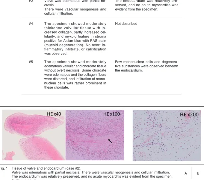 Table 4   Pathology of mitral valve and endocardium