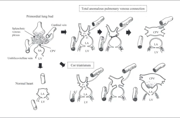 Fig. 1  Embryologic basis of total anomalous pulmonary venous connection and cor triatriatum