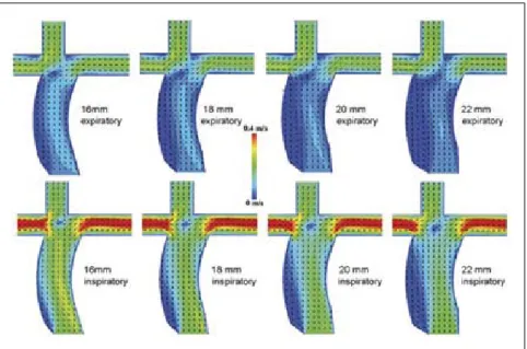 Fig. 4  Our numerical model: optimal conduit sizes considering energy loss and flow stag- stag-nation.