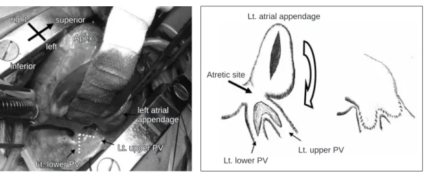 Fig. 2a: Operative view. 
