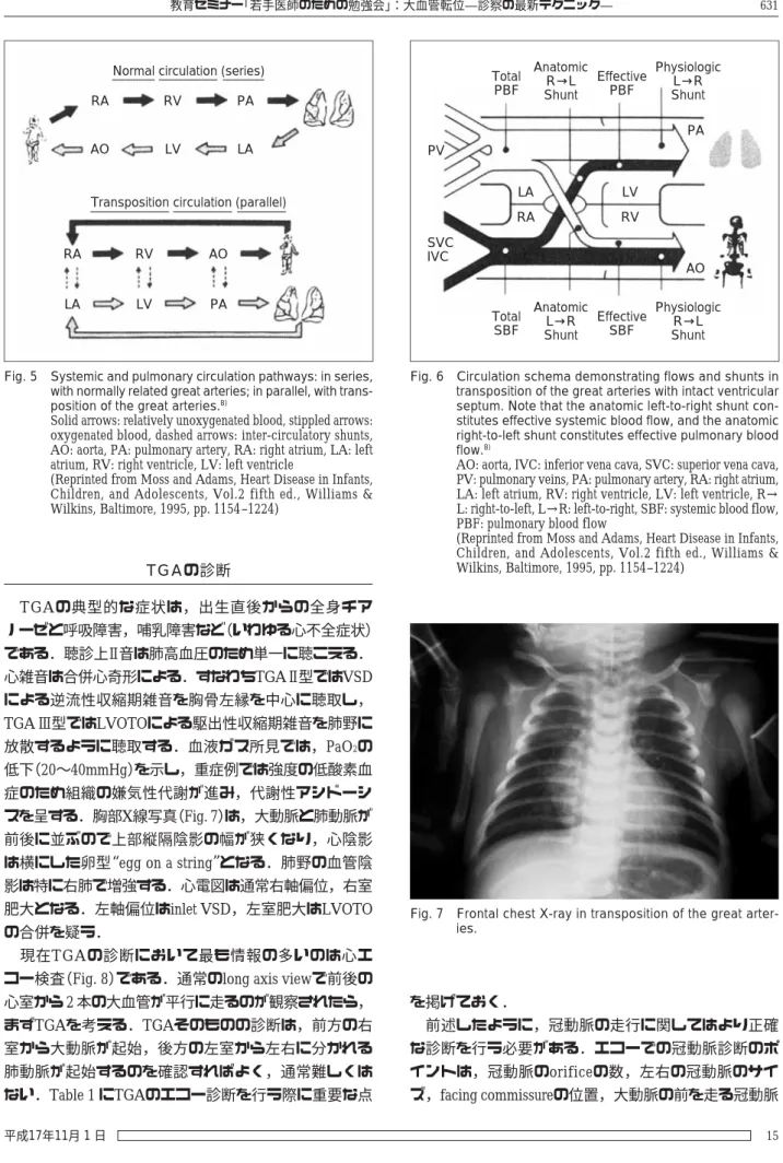 Fig. 7 Frontal chest X-ray in transposition of the great arter- Frontal chest X-ray in transposition of the great arter-ies.