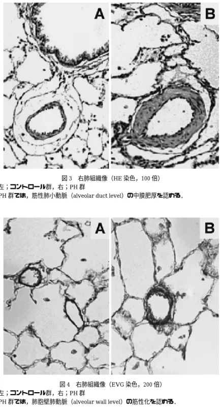 図 4 右肺組織像（EVG 染色，200 倍）