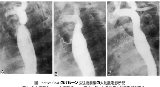 図 native CoA のバルーン拡張術前後の大動脈造影所見