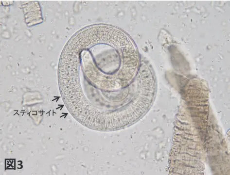 図 3  スティコサイト 検体を人工消化法により検査したところ、筋肉内に被嚢する幼 虫（図）や筋肉から脱嚢した幼虫（図）が回収された。虫体 の頭部側・食道部には、中央部に核を持つ極めて横長の方形の 細胞（スティコサイト）が、縦列して連続配置するスティコ ソームという構造が認められた  図筋肉内に被嚢する幼虫 図脱嚢した幼虫 図脱嚢した幼虫（拡大）