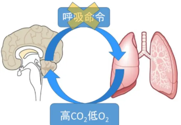 図  CCHS における低換気の特徴 