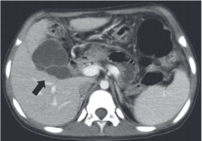 Fig. 1. The winding bile duct with partition walls can be