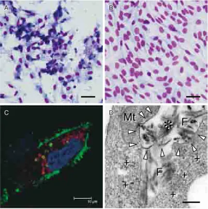 図 6　β2MG アミロイド線維の滑膜培養細胞に対する細胞傷害機序  A  ：β2MG アミロイド線維はウサギ滑膜由来線維芽細胞に対し細胞傷害性を有す る．β2MG アミロイド線維を含む培養液で培養すると，核濃縮や細胞質の膨 化，空胞化などの壊死性変化とともに，アポトーシス小体と考えられる核の断 片化を認めた．  B  ：陰性コントロール．スケールバー　50μm．  C  ：β2MG アミロイド線維は細胞内に取り込まれ，リソソームへ運ばれる．リソ ソーム（赤），β2MG（緑），核（青）を蛍光染色し，共焦点レ