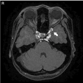 Fig. 1 MRA source image