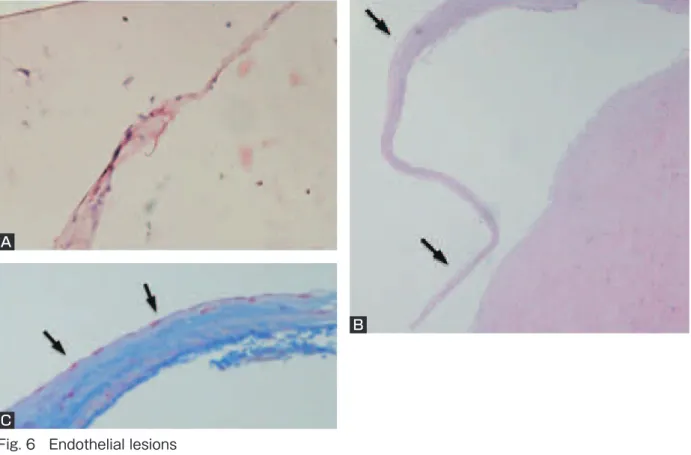 Fig. 6 Endothelial lesions A：Strips of endothelium. OM × 100.