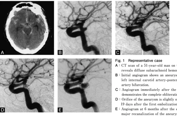 Fig. 1　Representative case