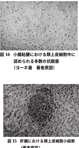 図 13 めん羊のヨーネ病症例の肥厚した 図 14 小腸粘腰における類上皮細胞中に 小腸粘膜（松井高車原図） 認められる多数の抗酸菌 （ヨーネ菌 著者原図） 発生事例 2 平成 7 年（ 1995 ）の北海道の某牧場での発生 例である。成めん羊 224 頭規模の群で慢性下痢 を呈する症例が発生し、帯広畜産大学において 病理学的、細菌学的にヨーネ病と鑑定された。 鑑定殺された病羊の下顎部は浮腫による腫脹 （ カラーグラビア Gl 参照 ）を示していた。 図小腸粘膜の肉眼所見として中程度の肥厚（ ）が、また、顕