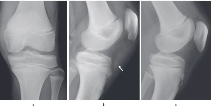 図 2　CT 像　a：冠状断．b：矢状断．
