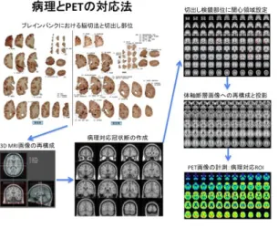 図 11  PET-病理対応法 