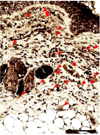 Fig. 1.  皮膚炎発症マウス皮膚における好塩基球 