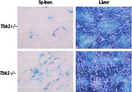 Figure 1. Ad‑mediated transgene expression in  Tbk1 +/‑ Tnf ‑/‑  mice and  Tbk1 +/‑ Tnf ‑/‑  mice following  Ad vectors administration.  Tbk1 +/‑ Tnf ‑/‑  mice and  Tbk1 +/‑ Tnf ‑/‑  mice were intravenously administered  with Ad‑LacZ at 5×10 10  vp/mouse. 