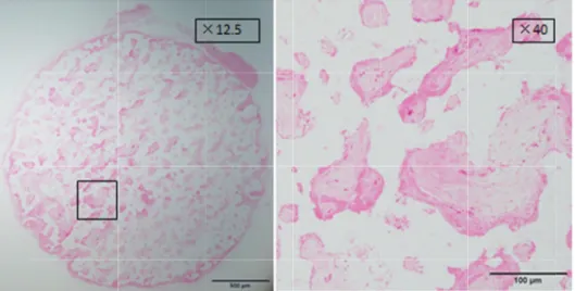 図 4 移植法による人工               4  ヒト骨髄初期培養細胞を使用して作製したヒト骨形成細胞シートの移植法による人工 ヒト骨髄初期培養細胞を使用して作製したヒト骨形成細胞シートの移植法による人工骨への骨形成の評価（組織像） ヒト骨髄初期培養細胞を使用して作製したヒト骨形成細胞シートの骨への骨形成の評価（組織像）   5-10  ヒト骨髄初期培養細胞を使用して作製したヒト骨形成細胞シートの骨への骨形成の評価（組織像）ヒト骨髄初期培養細胞を使用して作製したヒト骨形成細胞シートの骨への骨形成の