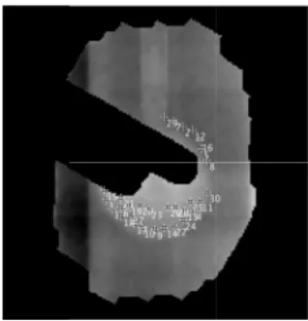 Fig.  6  VMAT 時の ROI の自動配置の様子。