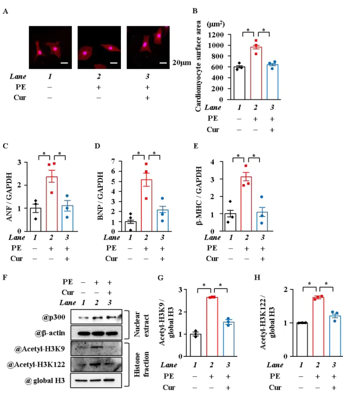 Figure 4.  クルクミン処理は PE 刺激による心筋細胞肥大とヒストンのアセチル化を抑制した