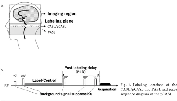 Fig. 1. Labeling locations of the CASL/pCASL and PASL and pulse sequence diagram of the pCASLASLのイメージング原理はじめに，ASLのイメージングの概要を説明する．ASLでは，血液の水分子を磁気的に標識（ラベル）するために，撮像領域よりも上流側の頸部領域において移動する血液の磁化を反転させる（Fig