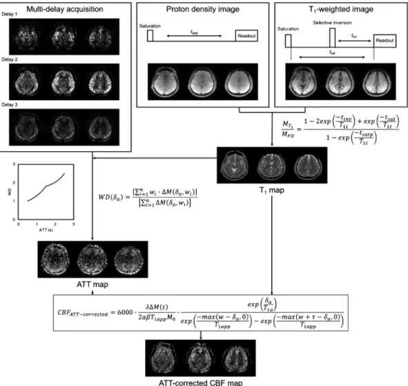 Fig. 4. Flowchart of CBF quantiˆcation using multi-delay ASL. First, ASL, proton density (PD), and T 1 - -weighted (T 1 w) images are obtained using a multi-delay sequence