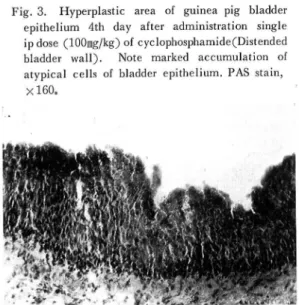 Fig.  3.  Hyperplastic  area  of  guinea  pig  bladder    epithelium  4th  day  after  administration  single   ip dose  (100mg/kg) of  cyclophosphamide(Distended    bladder  wall)