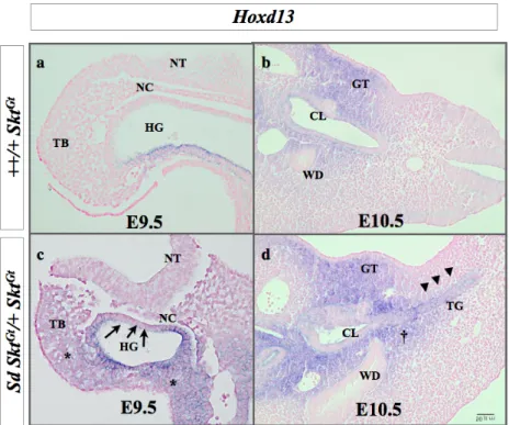 図 11.  Hoxd-13 発現パターン  (In situ hybridization)