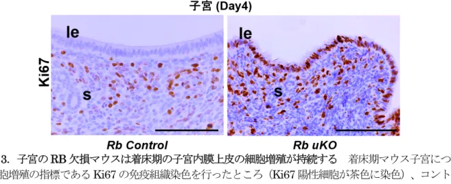 図 3 ．子宮の RB 欠損マウスは着床期の子宮内膜上皮の細胞増殖が持続する  着床期マウス子宮について 細胞増殖の指標である Ki67 の免疫組織染色を行ったところ（ Ki67 陽性細胞が茶色に染色）、コントロー ル（正常）マウスの子宮内膜上皮の Ki67 は消失し細胞増殖が停止状態だったが、RB 欠損マウスでは強く Ki67 が発現し細胞増殖が持続していた。 le =  子宮内膜上皮、 s =  子宮内膜間質。  図 4 ．着床部位の胚による子宮内膜上皮の死細胞の貪食作用  コントロールマウスでは子宮内