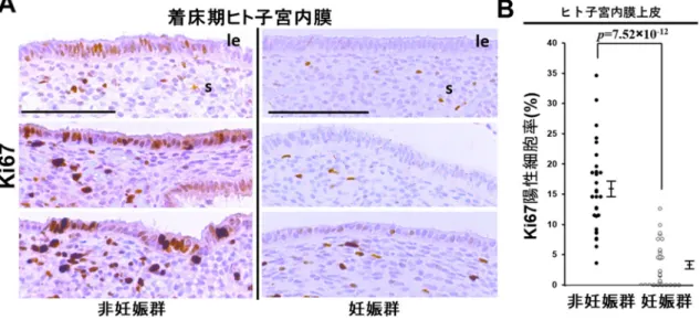 図 6 ．着床期ヒト子宮内膜において着床障害（非妊娠群）の子宮内膜上皮の細胞増殖は抑制される  着床 期ヒト子宮内膜に Ki67 免疫組織染色を行い細胞増殖の状態を評価した (A) 。その後の胚移植で妊娠した群