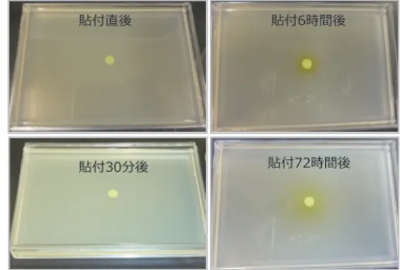 Fig.  5   Evaluation  of  drug  permeability  into  agar  medium from DDS sheet