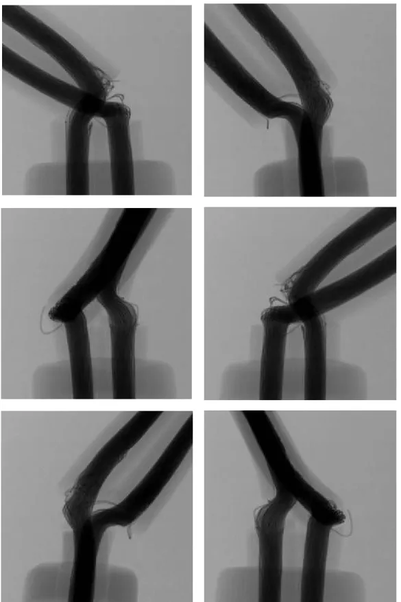 図 6-12    No. 10 の透過 X 線画像 
