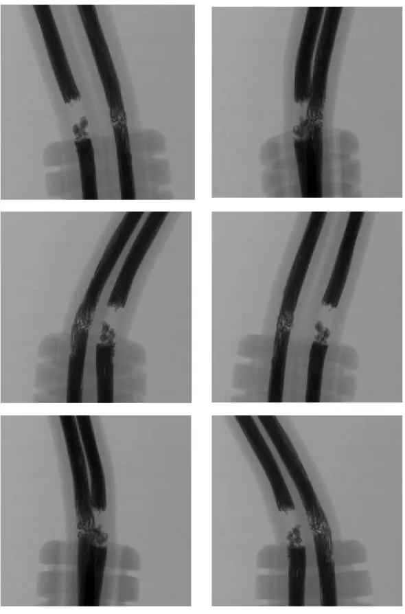 図 6-15    No. 11 の透過 X 線画像 