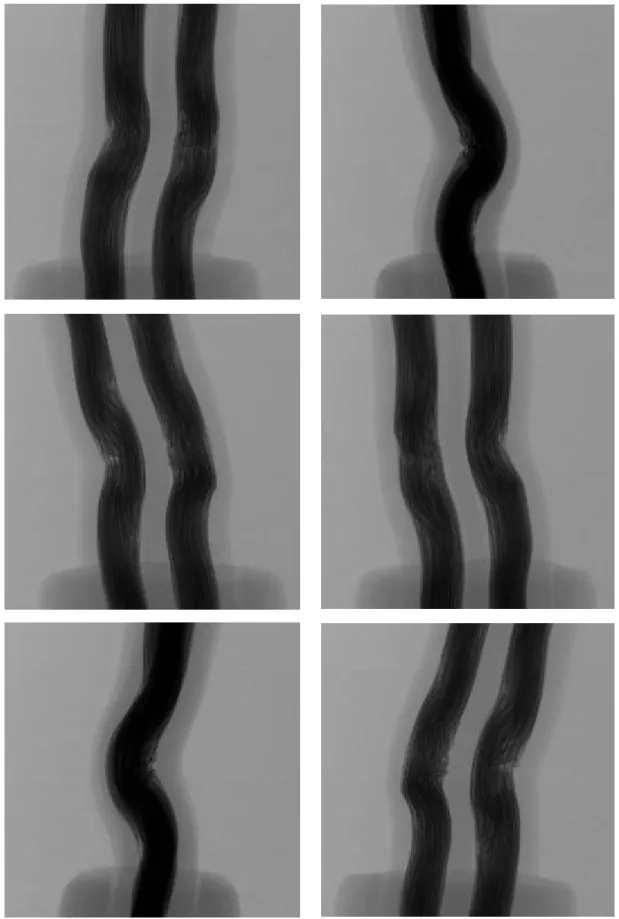 図  6-21    No. 41 の透過 X 線画像       