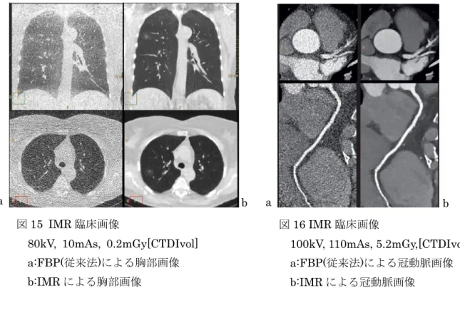図 15  IMR 臨床画像  80kV,  10mAs,  0.2mGy[CTDIvol]  a:FBP(従来法)による胸部画像  b:IMR による胸部画像  図 16 IMR 臨床画像    100kV, 110mAs, 5.2mGy,[CTDIvol] a:FBP(従来法)による冠動脈画像  b:IMR による冠動脈画像 a b a  b 