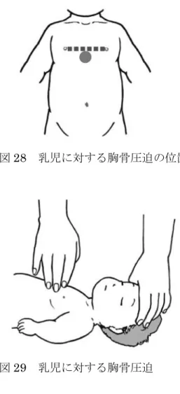 図 28  乳児に対する胸骨圧迫の位置  図 29  乳児に対する胸骨圧迫  3．1 歳未満の子ども（乳児）のへの対応気道異物  苦しそうで顔色が悪く、泣き声も出ないときは気道異物による窒息を疑います。窒息と判断すれば、 ただちに 119 番通報を誰かに依頼し、以下の対応を開始します。  反応がある間は頭部を下げて背部叩打と胸部突き上げを実施します。乳児では成人と異なり、腹部突 き上げは行いません。  背部叩打は、片方の手で乳児のあごをしっかり持ち、その腕うでに胸と腹を乗せて頭が下がるように してうつ伏せに