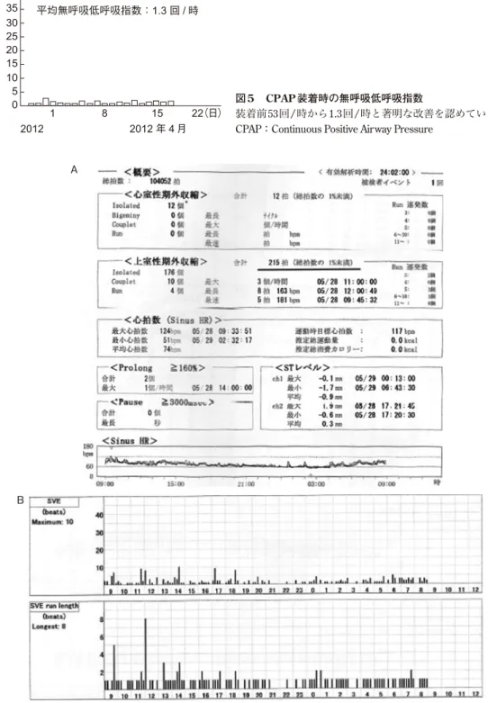 図 5 CPAP 装着時の無呼吸低呼吸指数