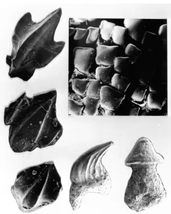 Fig.  6.  Dermal  denticles  of  the  magamouth  shark,  Megachasma pelagios （1）.  The  dorsal  surface  of  the skin is black and the ventral surface of the skin  is white（2）